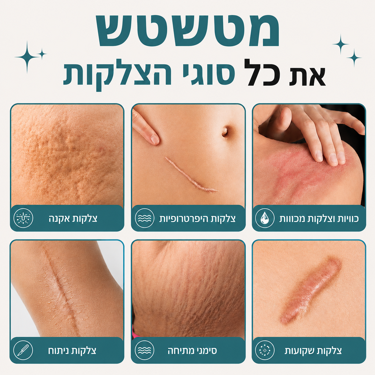 סרום לטשטוש צלקות