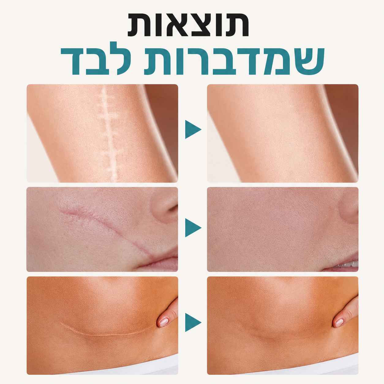סרום לטשטוש צלקות