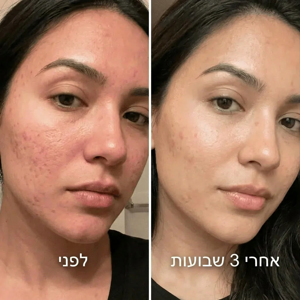 סרום לטשטוש צלקות